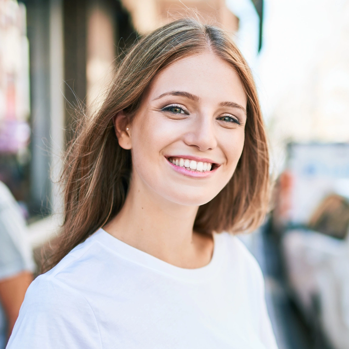 Bone Grafting results at Shining Smiles in Marietta, GA